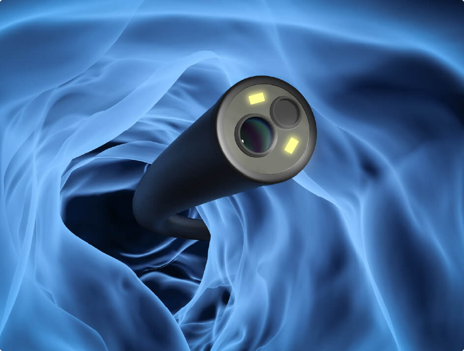 鼴鼠醫(yī)療帶您了解電子支氣管鏡的檢查流程