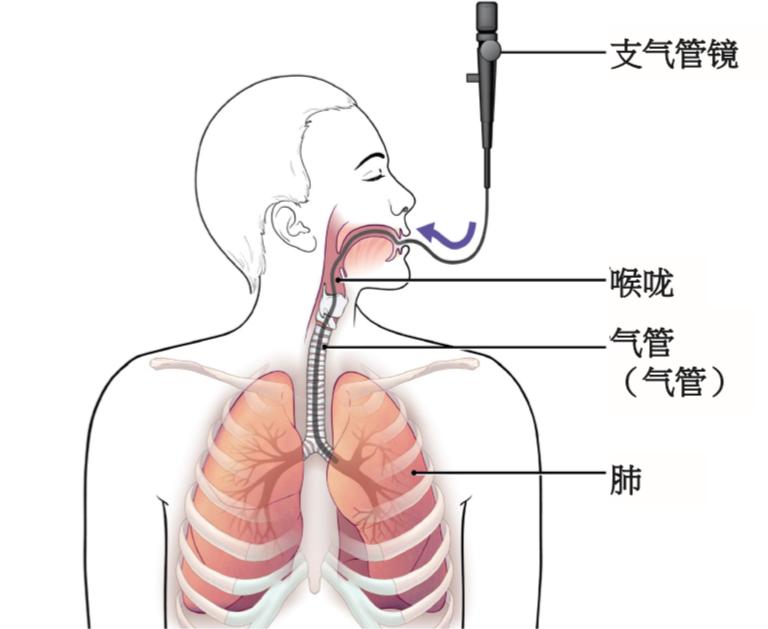 如何使用電子支氣管鏡：生產(chǎn)廠家提供的入境技巧指南