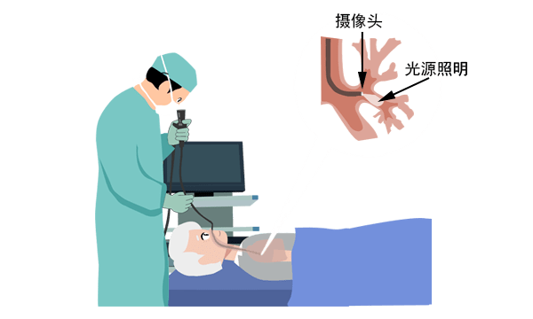 電子支氣管鏡可以應(yīng)用在臨床哪些科室呢.png 電子支氣管鏡可以應(yīng)用在臨床哪些科室呢.png