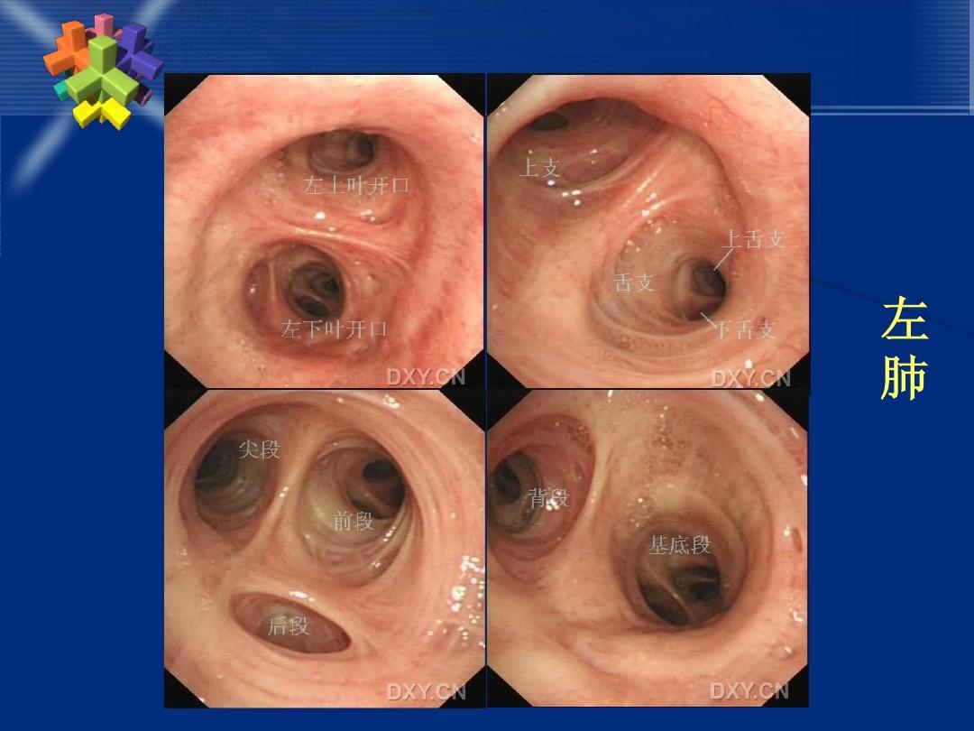 電子支氣管鏡可以應(yīng)用在臨床哪些科室呢.jpg 電子支氣管鏡可以應(yīng)用在臨床哪些科室呢.jpg